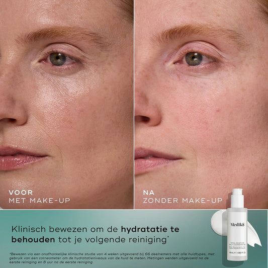 Total moisture daily cleansing gel
